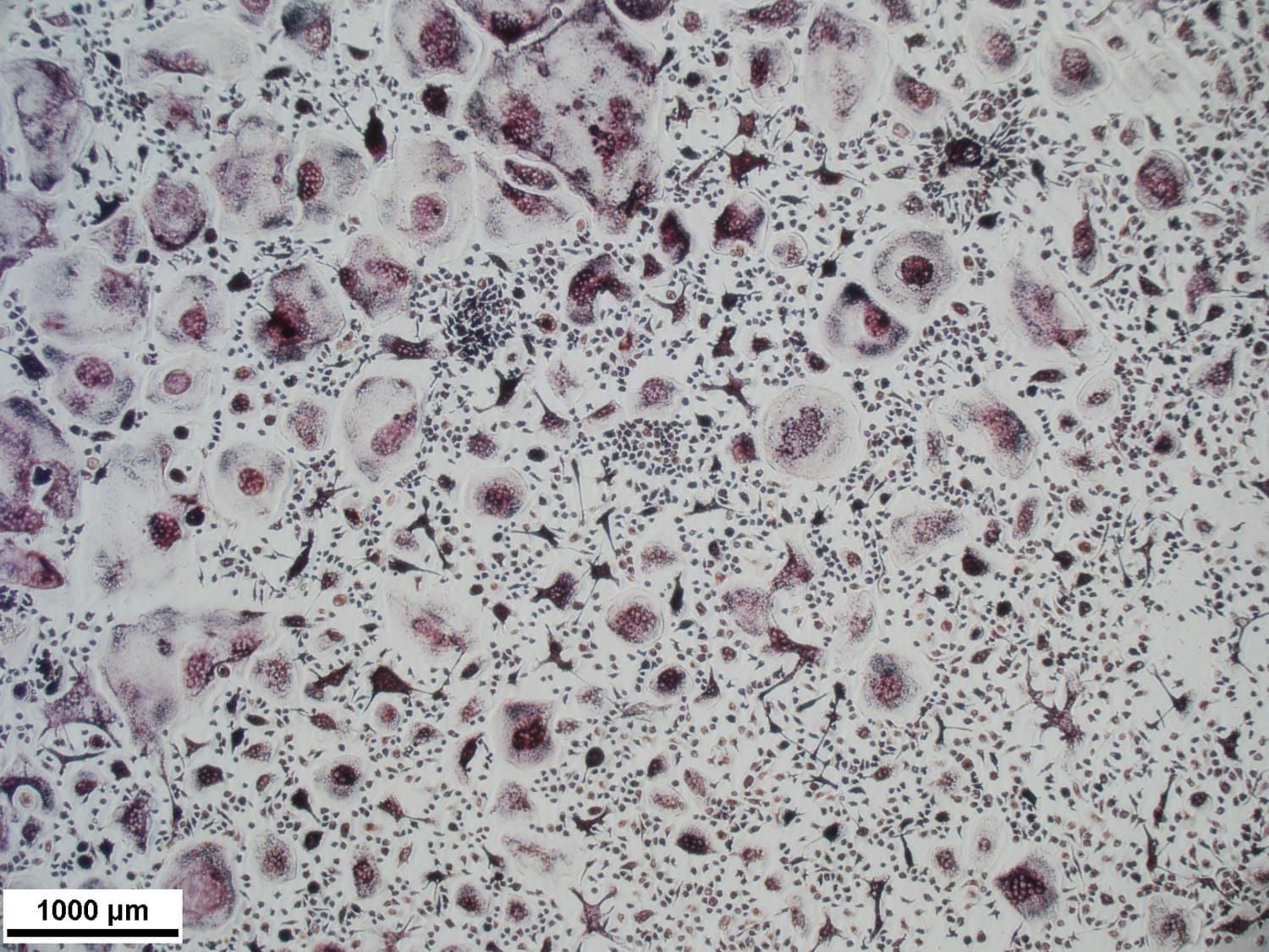 Recombinant Human TRANCE/RANK L/TNFSF11 Protein 390-TN