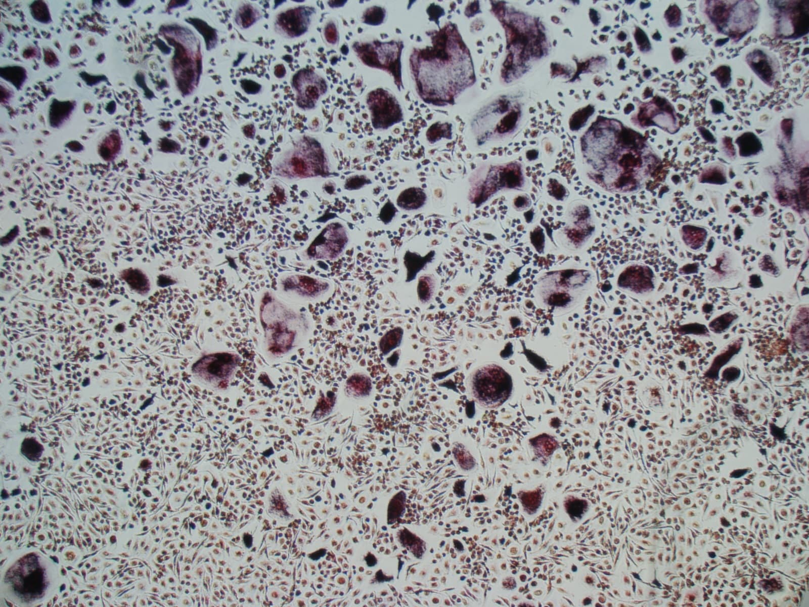 Recombinant Human TRANCE/RANK L/TNFSF11 Protein 390-TN