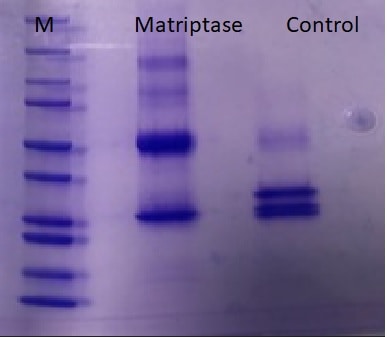 Recombinant Human Matriptase/ST14 Catalytic Domain, CF 3946-SEB