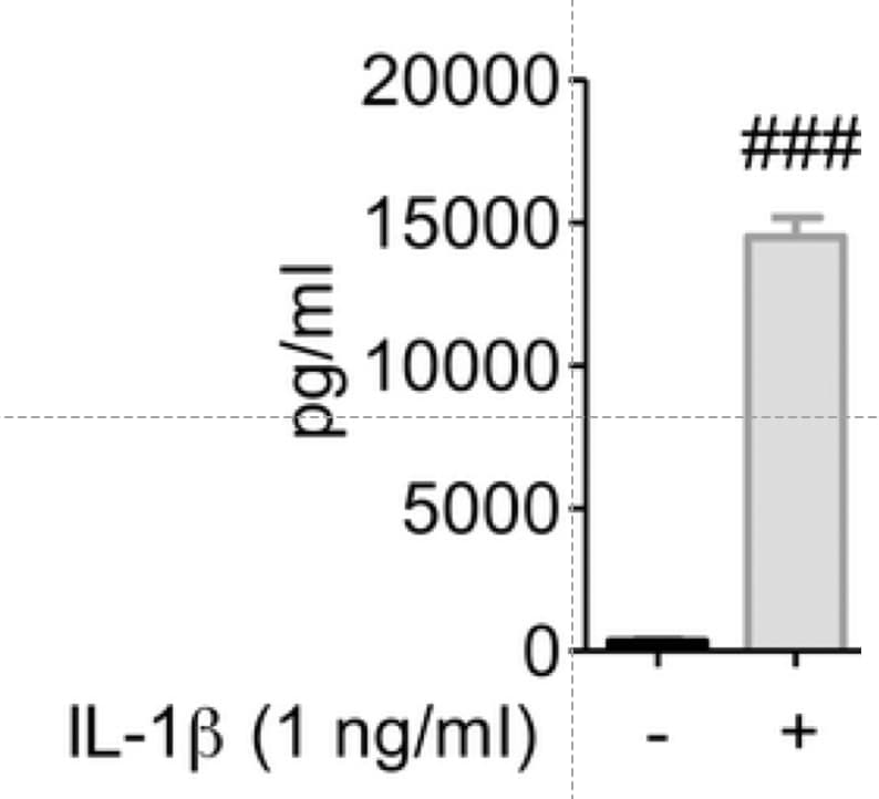 Recombinant Mouse IL-1 beta/IL-1F2 Protein 401-ML