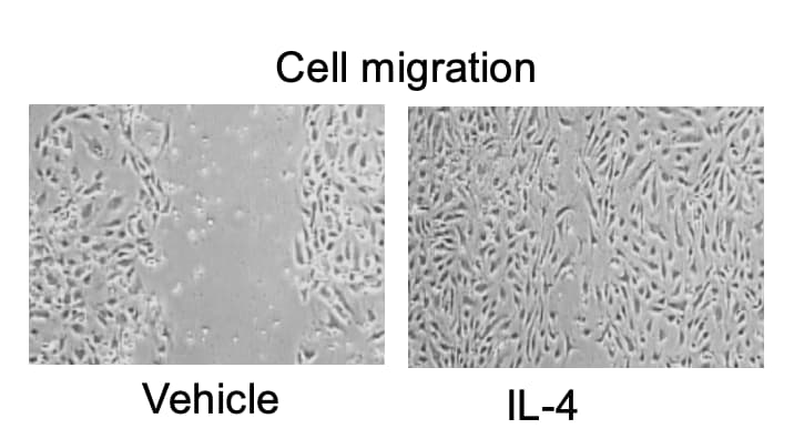 Recombinant Mouse IL-4 Protein 404-ML