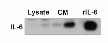 Recombinant Mouse IL-6 Protein 406-ML