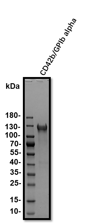 Recombinant Human CD42b/GPIb alpha Protein, CF 4067-GP