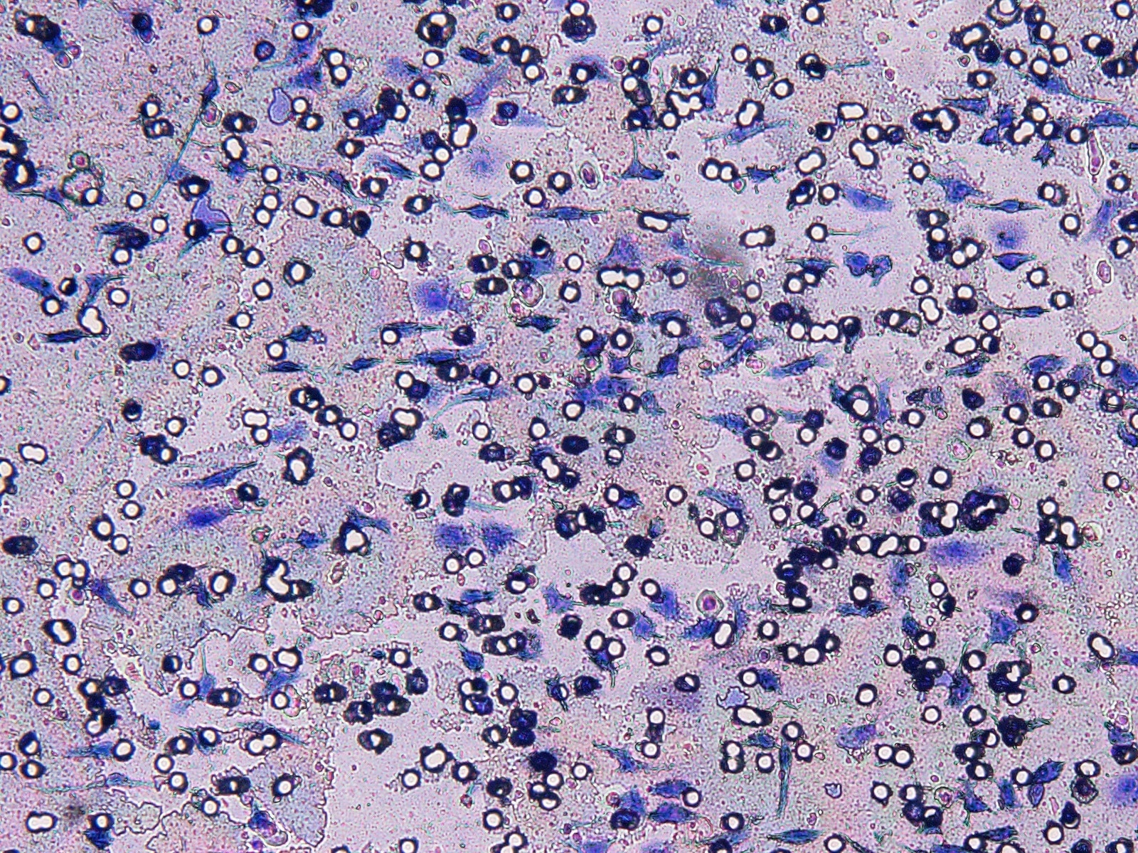 Recombinant Mouse M-CSF Protein 416-ML