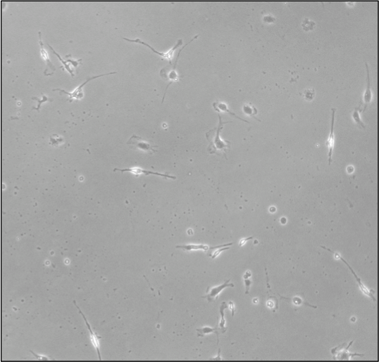 Recombinant Mouse M-CSF Protein 416-ML