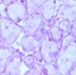 Recombinant Mouse M-CSF Protein 416-ML