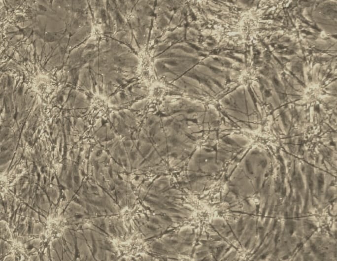 Recombinant Human/Mouse FGF-8b Protein 423-F8