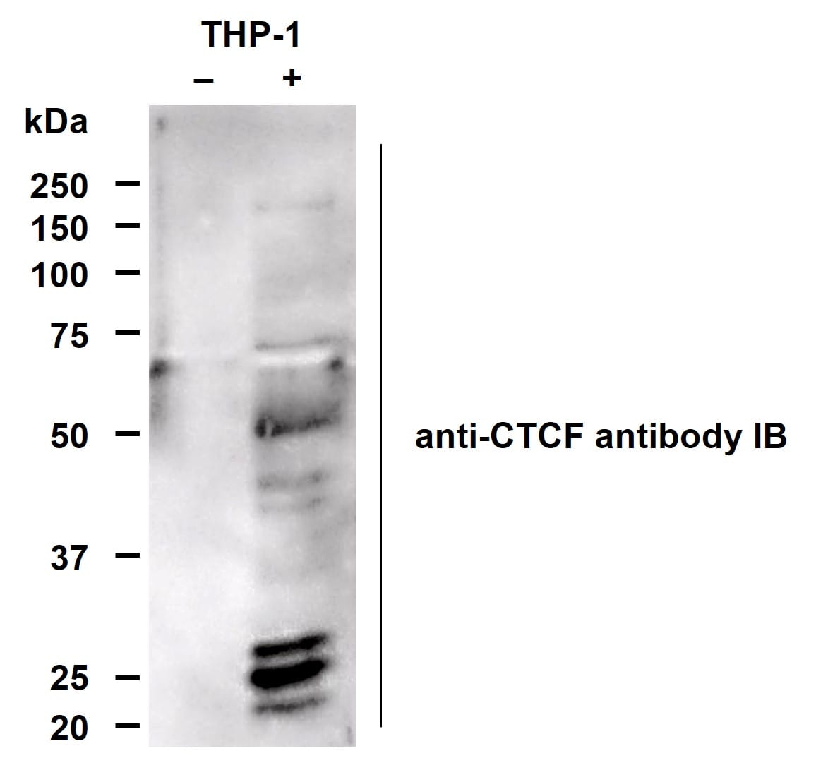 PAR/pADPr Antibody 4335-MC-100
