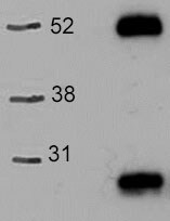 Recombinant Mouse Osteopontin/OPN Protein 441-OP
