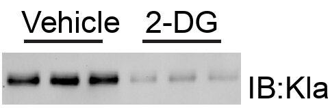 2-Deoxy-D-glucose 4515