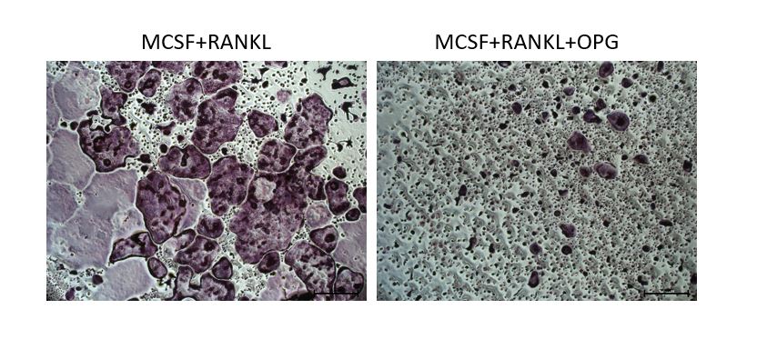 Recombinant Mouse Osteoprotegerin/TNFRSF11B Fc Chimera, CF 459-MO