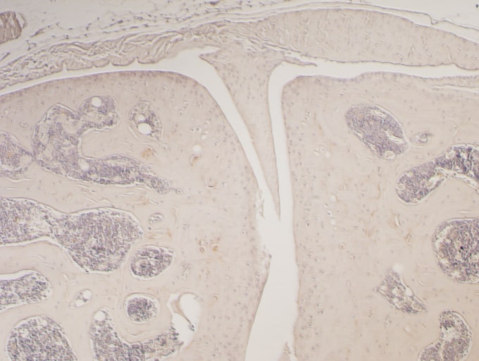 Recombinant Mouse TRANCE/RANK L/TNFSF11 (E. coli-expressed) 462-TEC