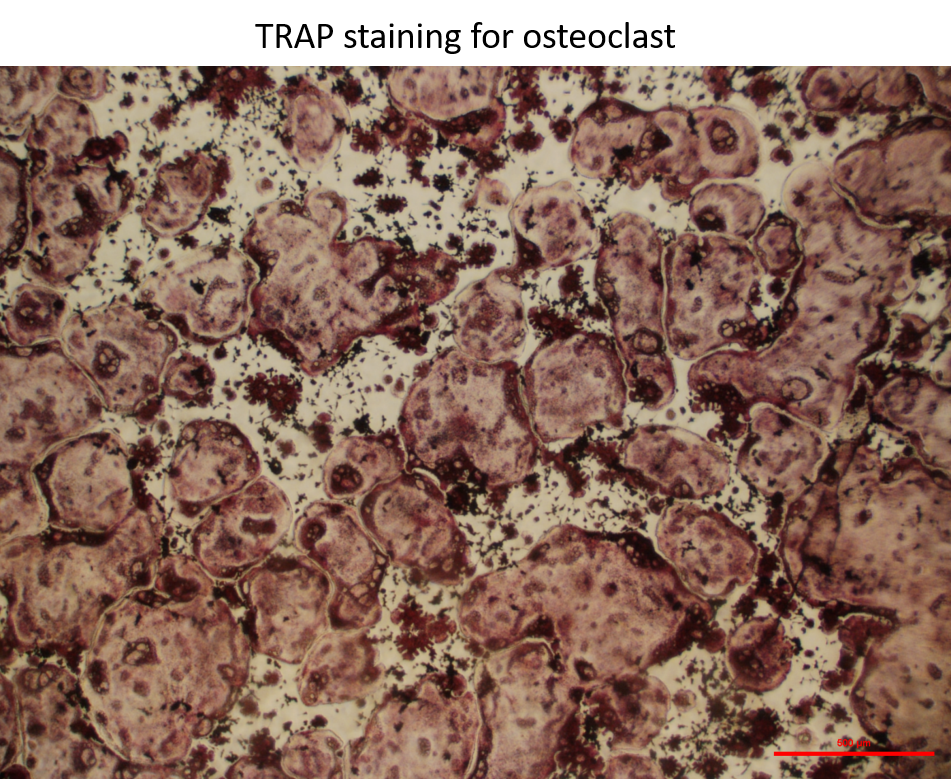 Recombinant Mouse TRANCE/RANK L/TNFSF11 (E. coli-expressed) 462-TEC