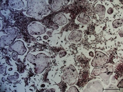 Recombinant Mouse TRANCE/RANK L/TNFSF11 (E. coli-expressed) 462-TEC