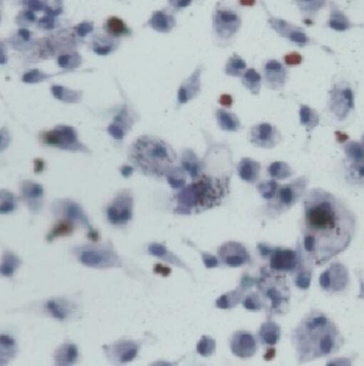 Recombinant Mouse TRANCE/RANK L/TNFSF11 (E. coli-expressed) 462-TEC