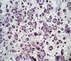 Recombinant Mouse TRANCE/RANK L/TNFSF11 (E. coli-expressed) 462-TEC
