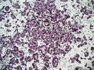 Recombinant Mouse TRANCE/RANK L/TNFSF11 (E. coli-expressed) 462-TEC