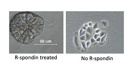 Recombinant Human R-Spondin 1 Protein 4645-RS