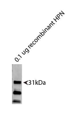 Recombinant Human Hepsin Protein, CF 4776-SE