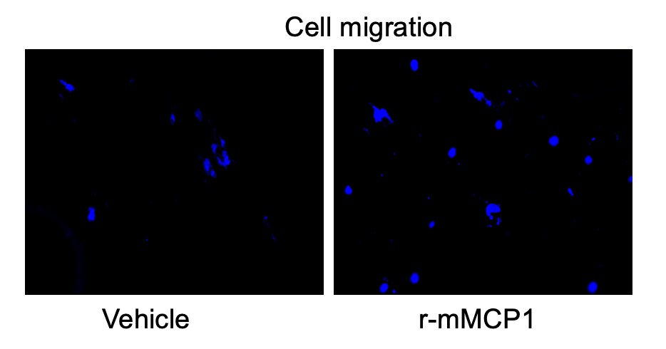 Recombinant Mouse CCL2/JE/MCP-1 Protein 479-JE
