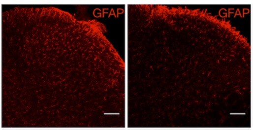 Methylprednisolone 4819