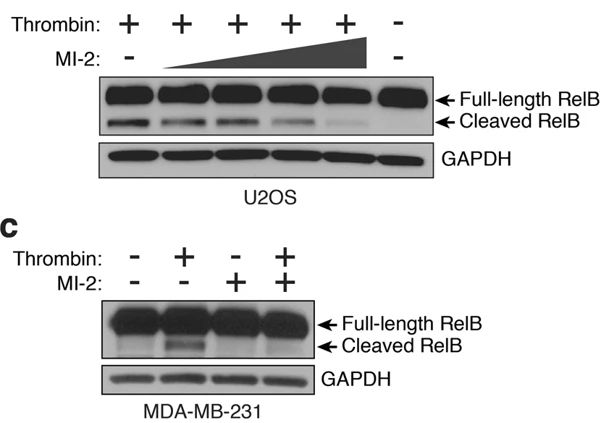 MI 2 (MALT1 inhibitor) 4848