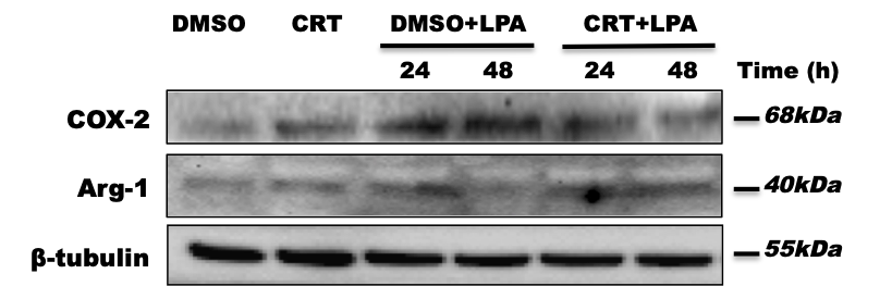 CRT 0066101 4975