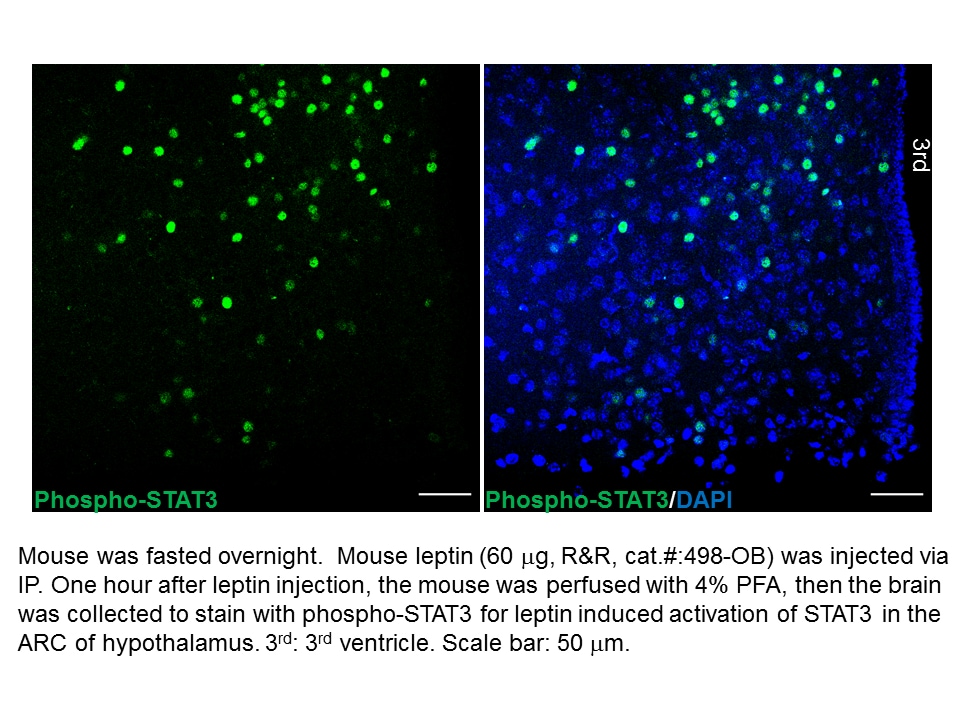 Recombinant Mouse Leptin Protein, CF 498-OB