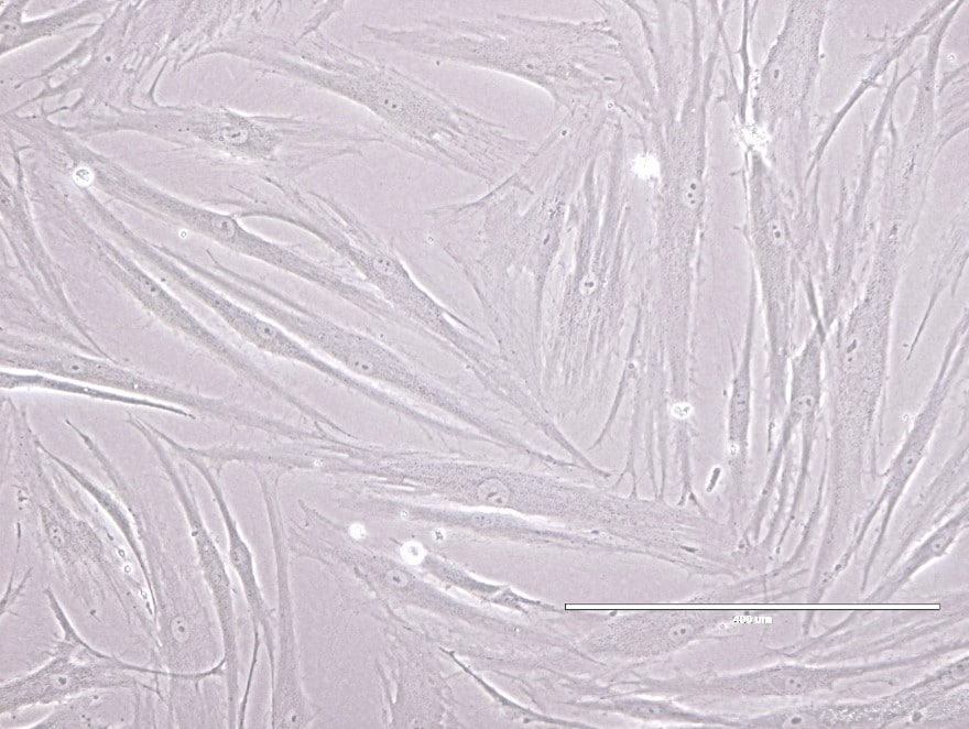Recombinant Human Wnt-3a Protein 5036-WN