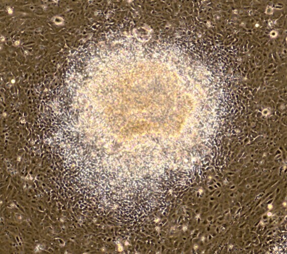 Recombinant Rat PDGF-BB Protein 520-BB