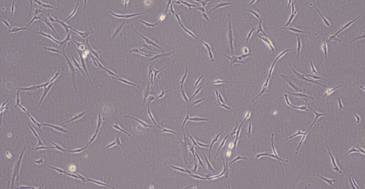 Recombinant Rat PDGF-BB Protein 520-BB