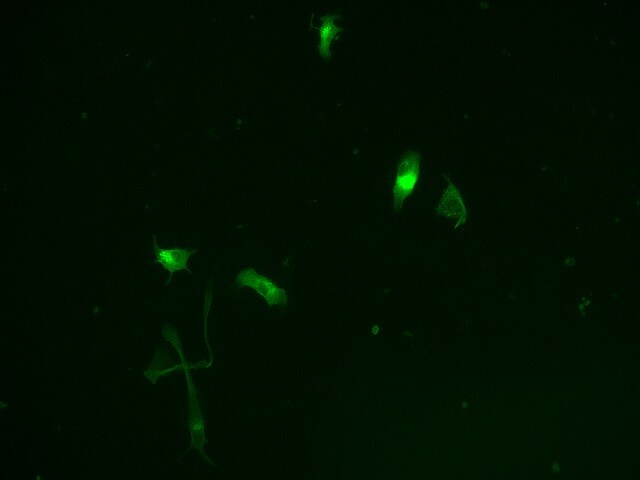 Recombinant Human IL-34 Protein 5265-IL