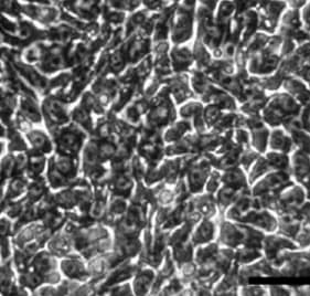Recombinant Human Integrin alpha 4 beta 7 Protein, CF 5397-A3