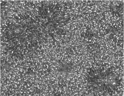 Recombinant Human Noggin Protein 6057-NG
