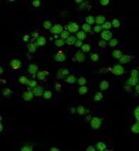 Recombinant Human Noggin Protein 6057-NG