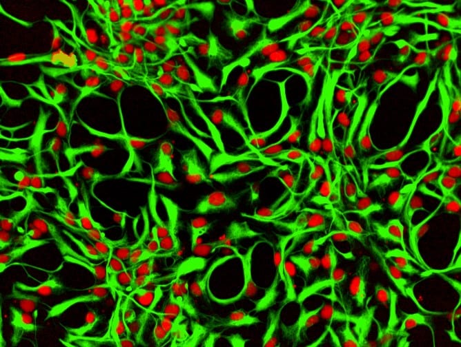 Recombinant Human Noggin Protein 6057-NG
