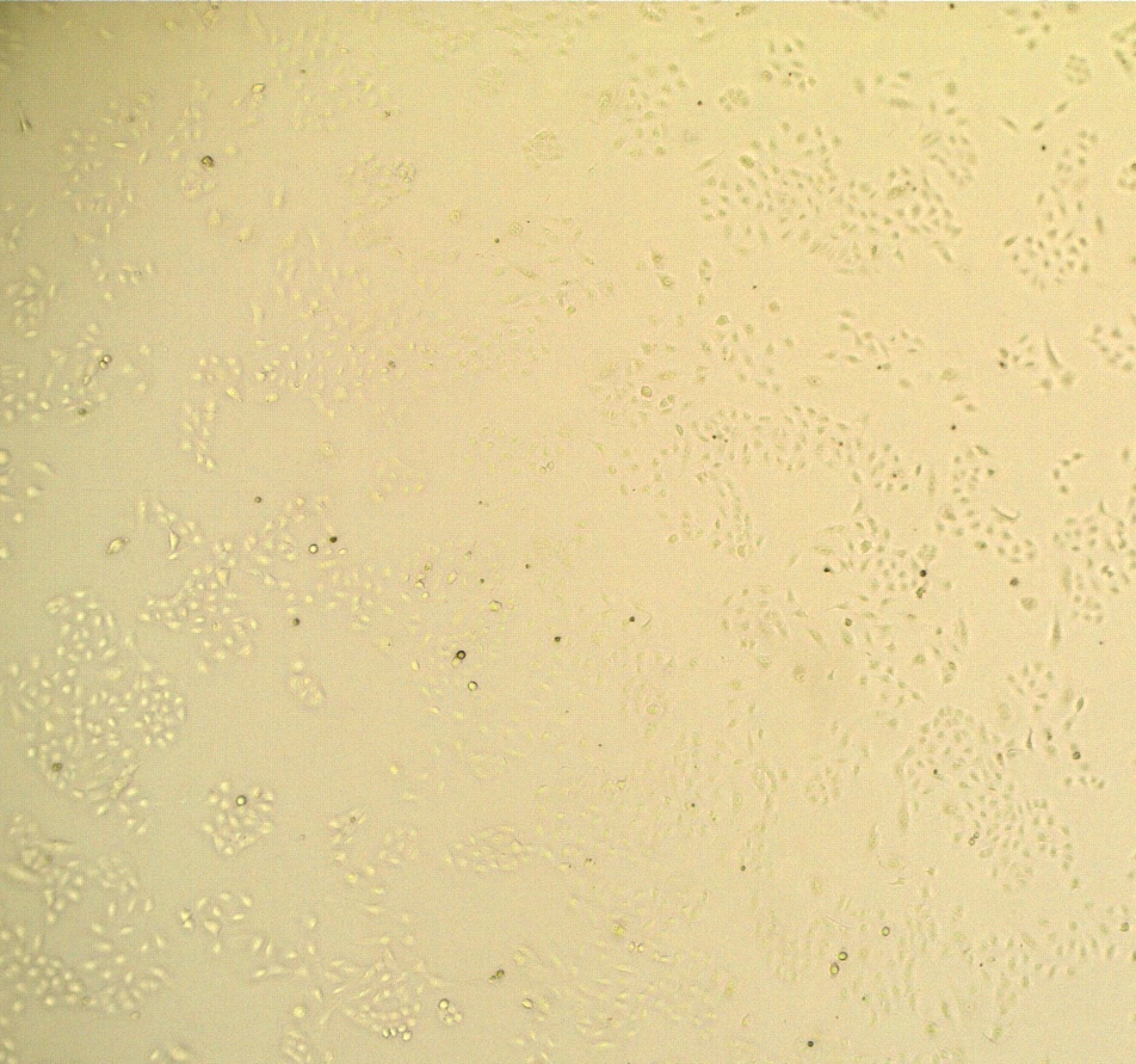 Recombinant Human Noggin Protein 6057-NG