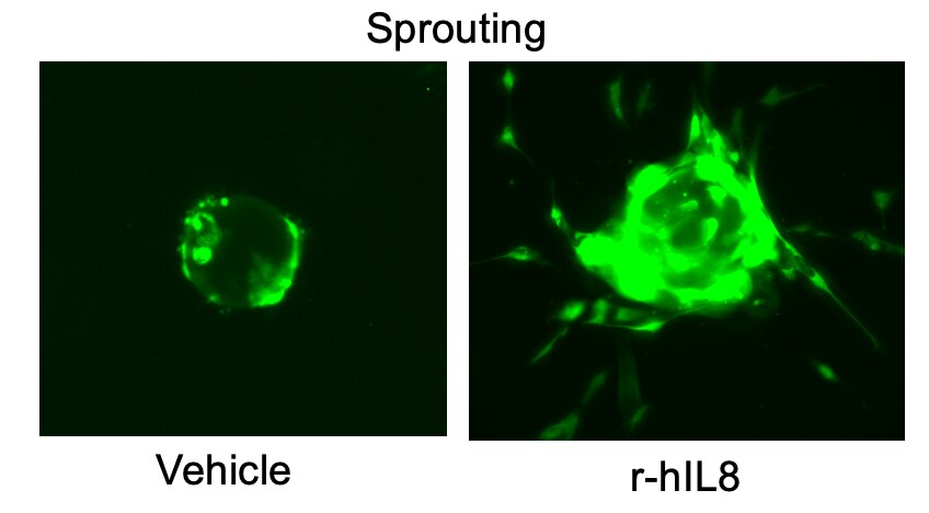 Recombinant Human IL-8/CXCL8 (Endothelial Cell Derived) 618-IL