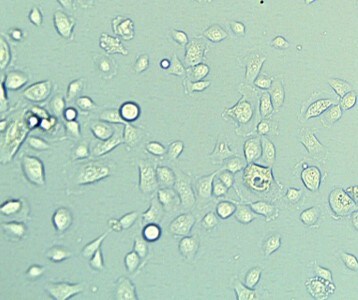Recombinant Human IL-8/CXCL8 (Endothelial Cell Derived) 618-IL
