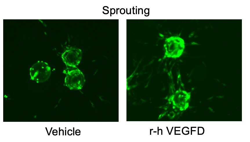 Recombinant Human VEGF-D Protein 622-VD