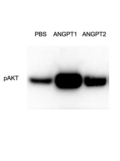 Recombinant Human Angiopoietin-2 Protein 623-AN