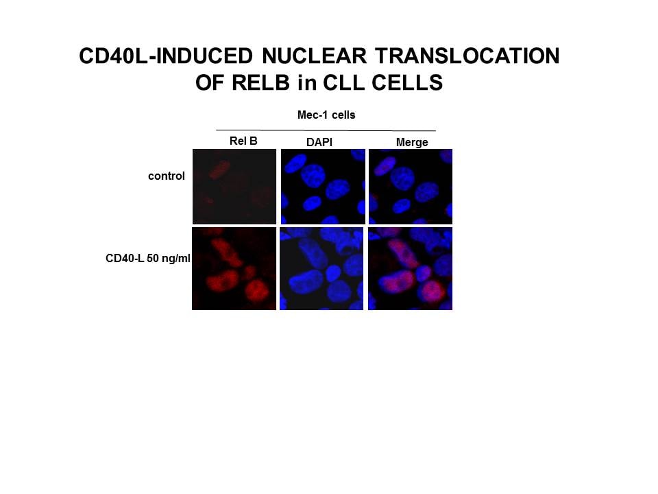 Recombinant Human CD40 Ligand/TNFSF5 (HEK293-expressed) 6420-CL