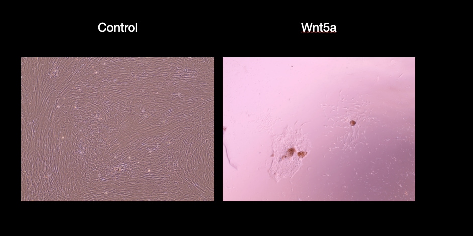 Recombinant Human/Mouse Wnt-5a Protein 645-WN