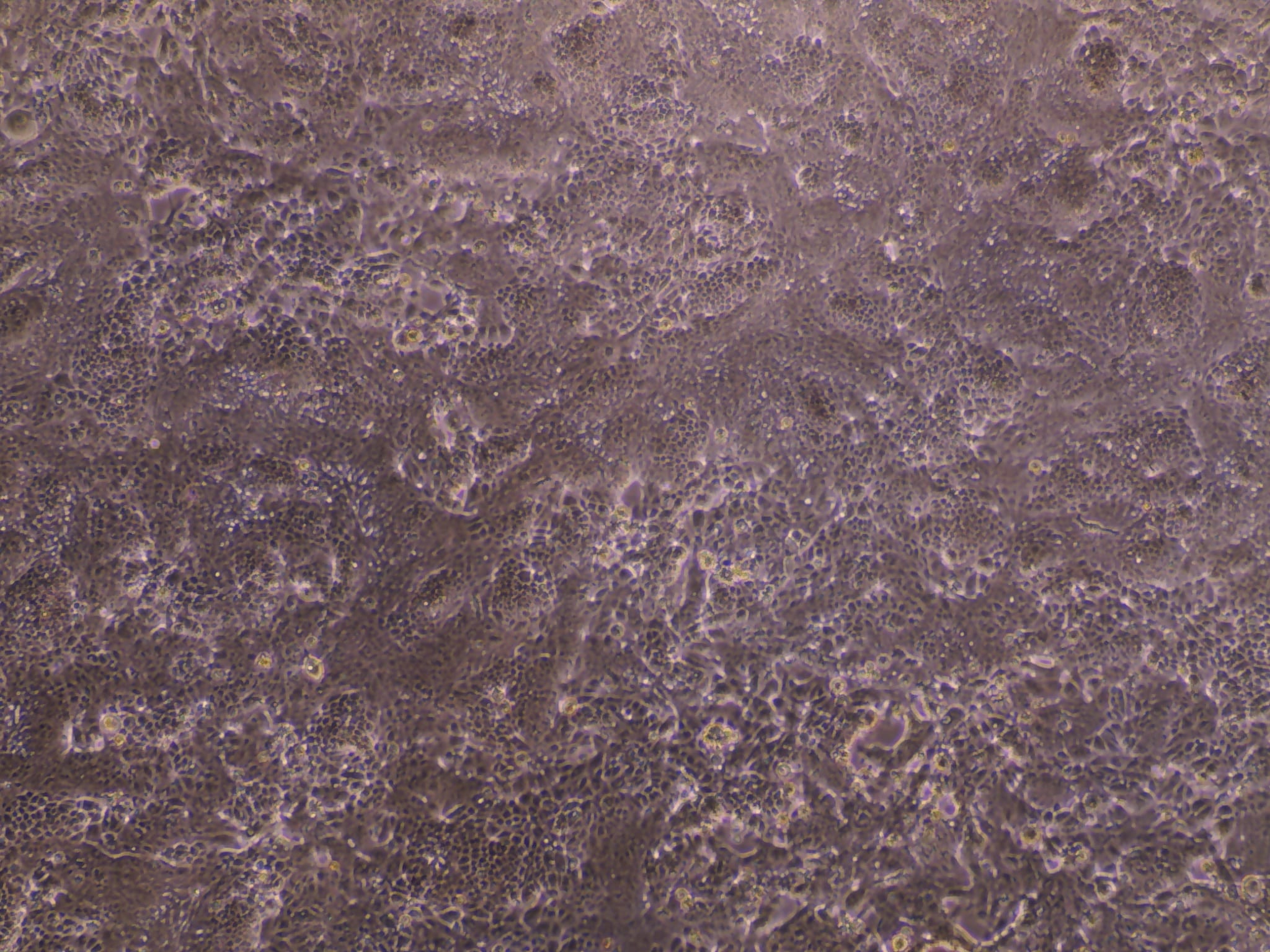 Recombinant Human/Mouse Wnt-5a Protein 645-WN