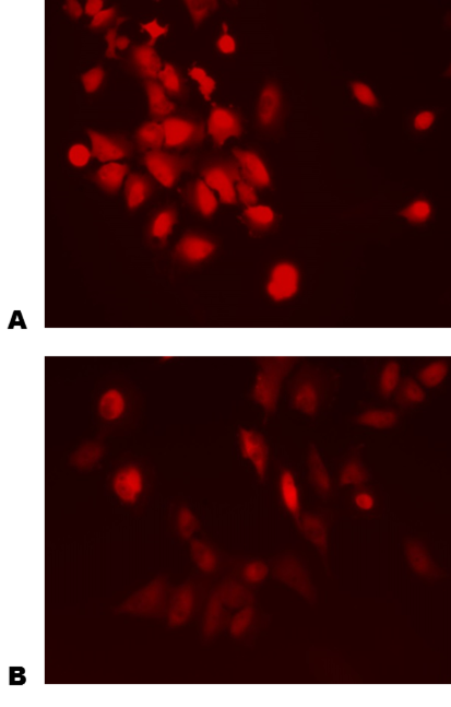 Recombinant Human Dkk-2 Protein 6628-DK