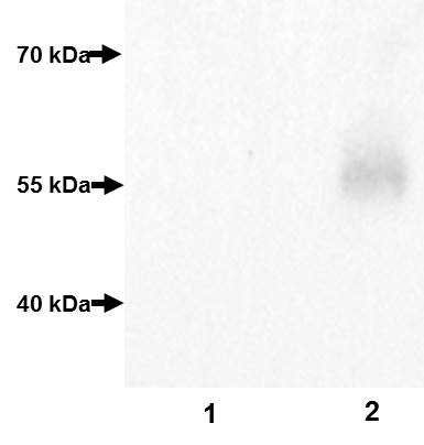 Recombinant Human a-N-acetylgalactosaminidase Protein, CF 6717-GH