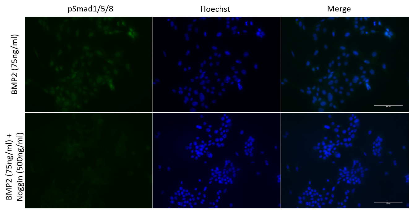 Recombinant Mouse Noggin (aa 28-232) Protein 6997-NG