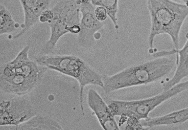Y-27632 in solution 7000
