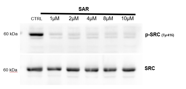 Saracatinib 7189