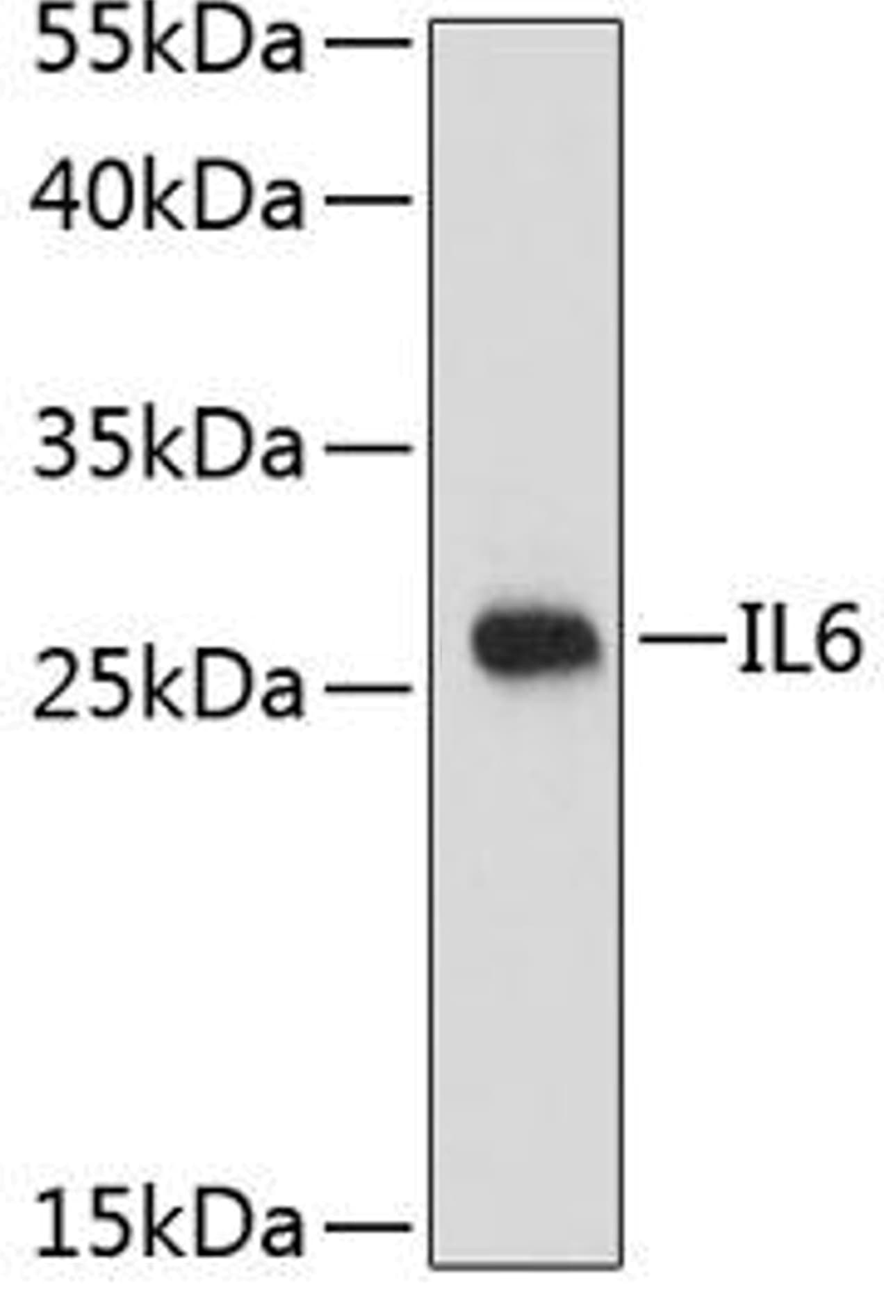 Recombinant Human IL-6 (HEK293-expressed) Protein 7270-IL